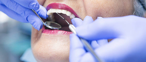 Best Emergency Wisdom Tooth Extraction in Cedar Heights, MD
